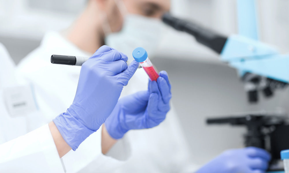 a scientist doing an organic acids test in a lab