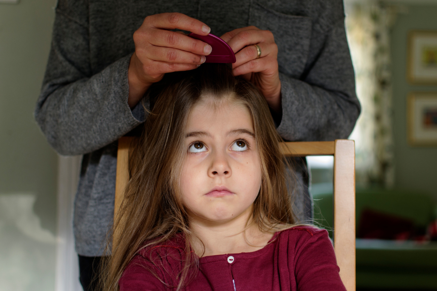 How to Get Rid of Lice Without Chemicals