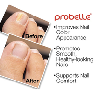 Thumbnail for Natural Nail Renewal Gel