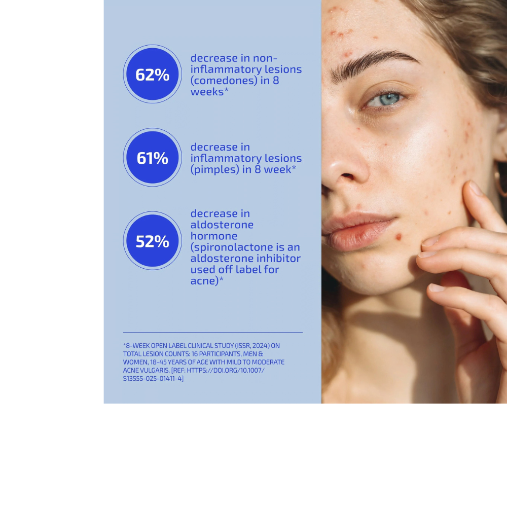 SHAANT Skin De-Stress Supplement 2.0 for Hormonal Acne
