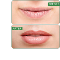 Thumbnail for Spearmint Ultra Moisturizing Organic Lip Balm
