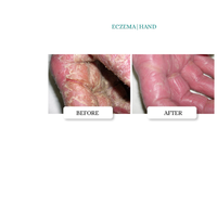 Thumbnail for INTENSIVE SKIN REPAIR  OINTMENT