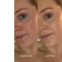 Thumbnail for SERUM FOUNDATION - RADIANT