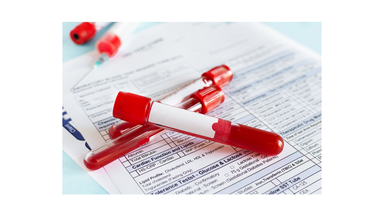 On-Site Blood Draw